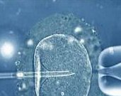 试管婴儿对于优势卵泡要求,泰国杰特宁按患者情况促排